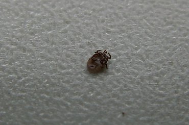 To dziadostwo miałem między małym a dużym palcem u nogi. Sam wyjąłem :] #kleszcz #pajęczak